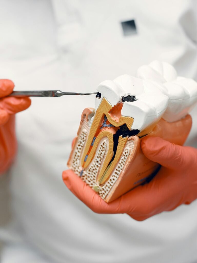 Wisdom Tooth Extraction Vancouver / Burnaby / New Westminster