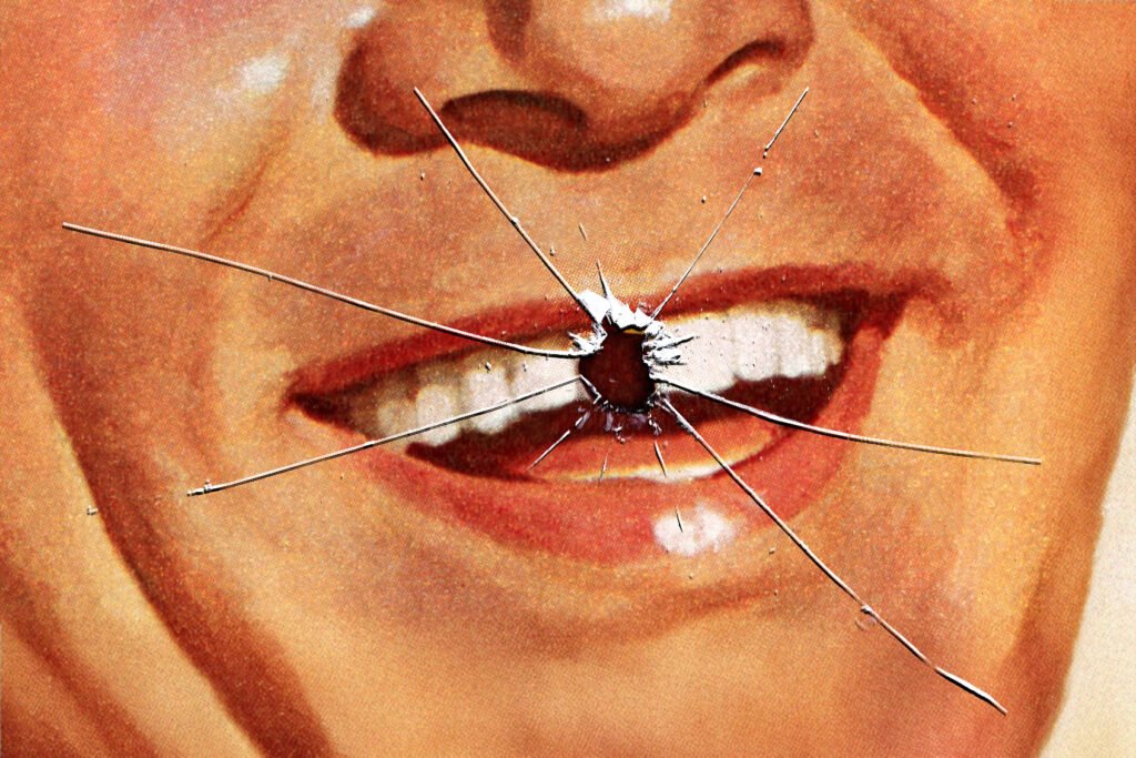 Broken Tooth in Vancouver? What to Do Before You Reach the Dentist