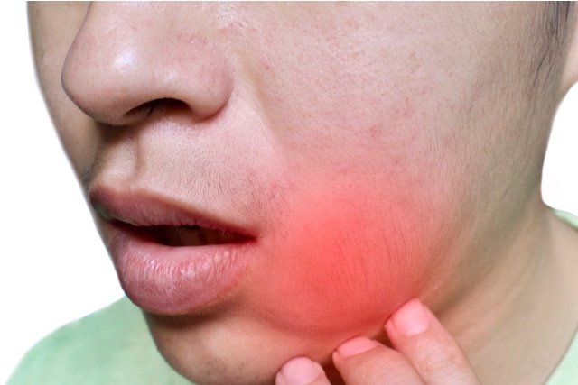 Toothache at Night? What Vancouver Residents Should Do Immediately